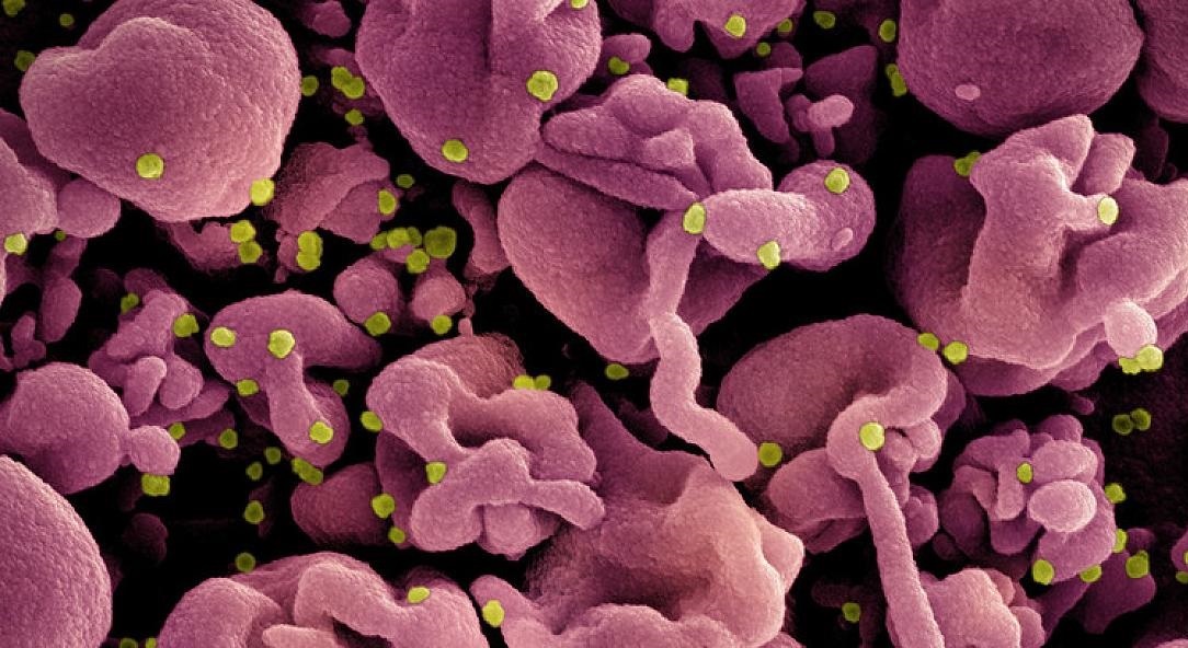 NIH-funded study finds long COVID affects adolescents differently than younger children